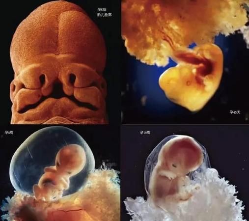胚芽发育成什么：幼叶胚芽