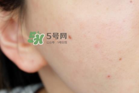 腊梅是什么牌子？腊梅是什么护肤品