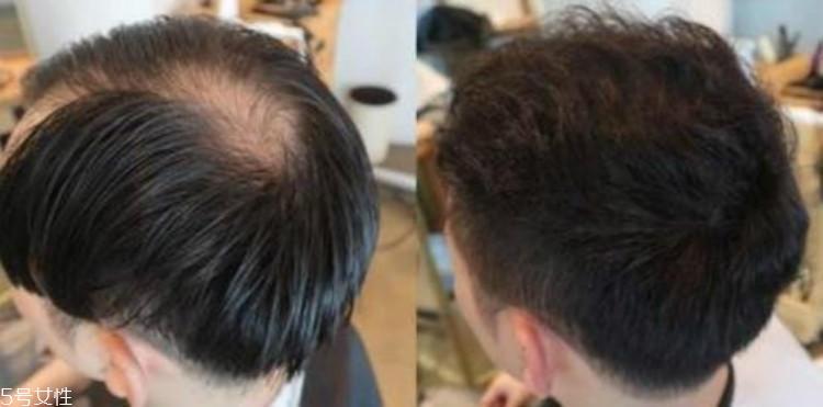 男生烫发有几种烫法 3种基础烫发要了解
