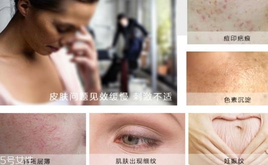德国krauterhof蜗牛精华膏效果怎么样？