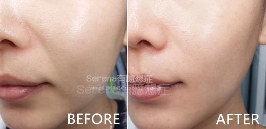 dermawand逆龄射频注氧棒怎么用？