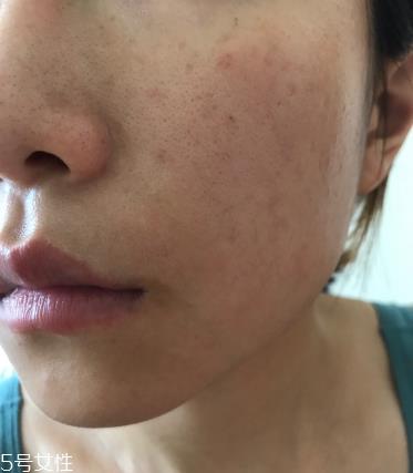 伊索焕彩滋润精露怎么样 aesop伊索焕彩滋润精露好用吗
