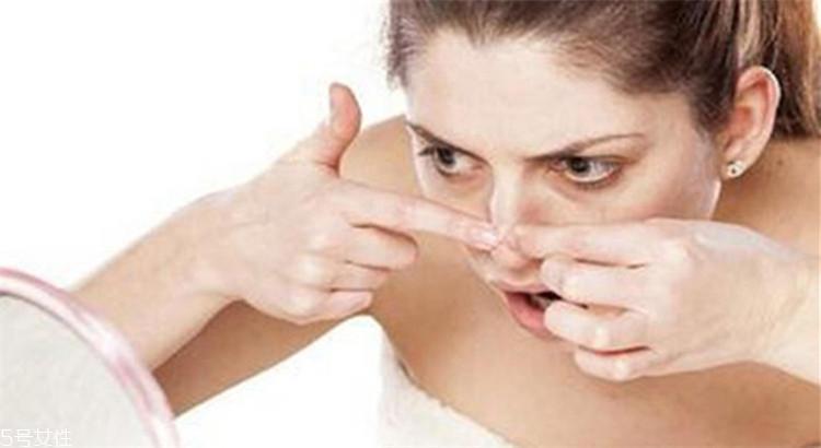 黑头越去越多怎么办 去黑头三大禁忌 黑头越去越多怎么办 去黑头三大禁忌