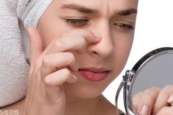 黑头越去越多怎么办 去黑头三大禁忌 黑头越去越多怎么办 去黑头三大禁忌