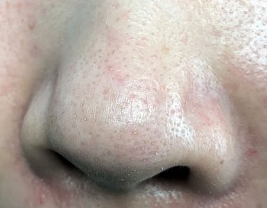 ​如何变白脸部 怎样让这样脏兮兮的脸变得白净点？