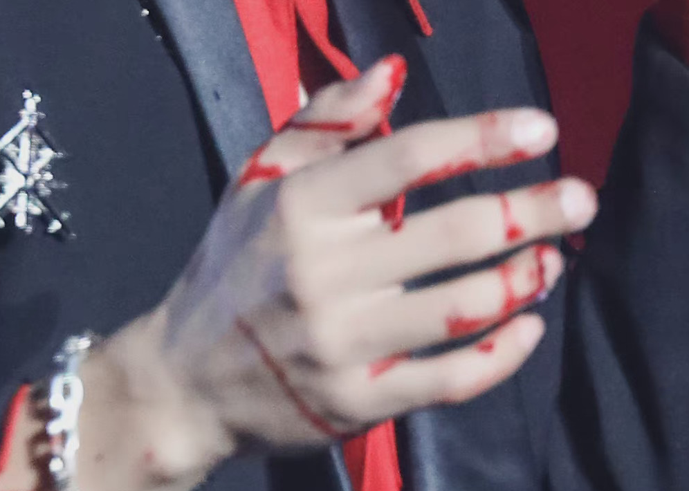 张杰演唱会发生意外!从摔下升降台背部着地,手受伤流血坚持表演