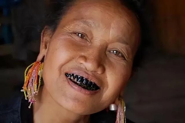 槟榔几级致癌物（国际公认1级致癌物）(9)