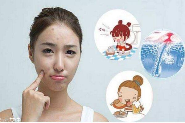 经常熬夜脸上长痘痘怎么办 熬夜起痘痘怎么调理 经常熬夜脸上长痘痘怎么办 熬夜起痘痘怎么调理