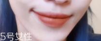 怎么变成樱桃小嘴？大嘴唇变小攻略