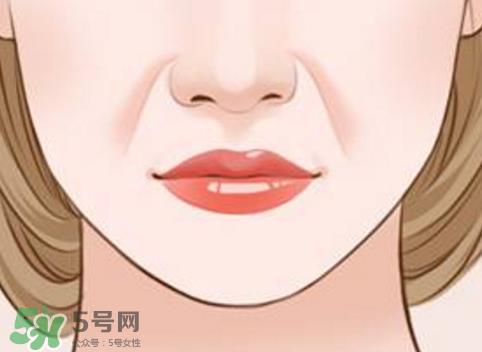 法令纹怎么消除?如何正确对待法令纹? 法令纹怎么消除?如何正确对待法令纹?