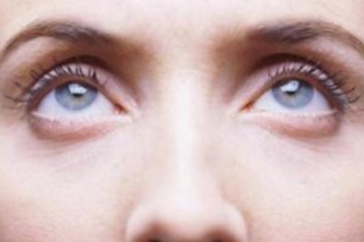 ​眼袋肿了怎么办才能消肿 眼袋浮肿怎么回事