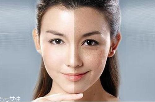 刷酸时要注意什么 刷酸去闭口操作指南 刷酸时要注意什么 刷酸去闭口操作指南