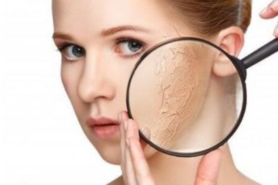 皮肤干燥脱皮严重像鱼鳞怎么办 皮肤干燥起皮像鱼鳞是怎么回事