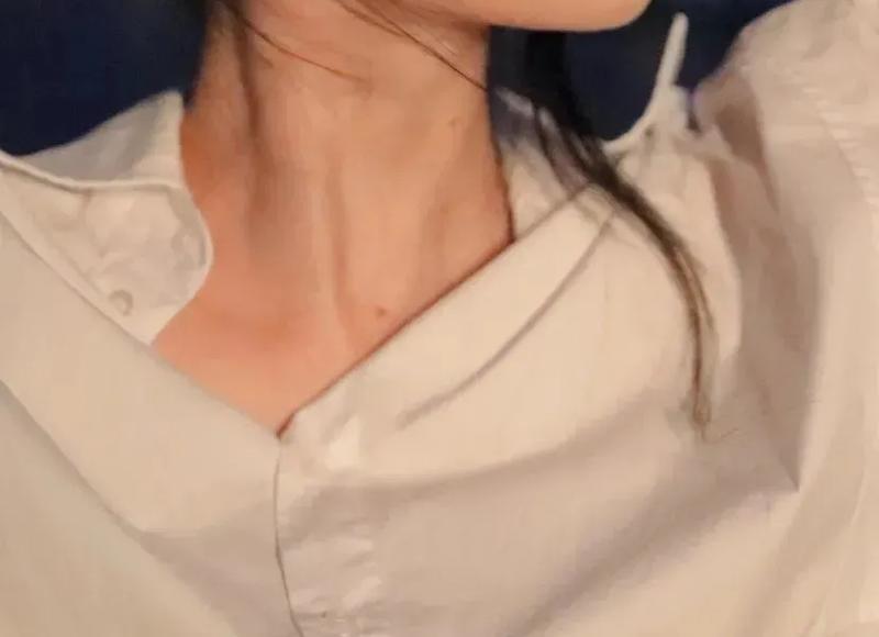 腋窝汗味重是不是狐臭的原因 腋窝汗味重与狐臭的关系